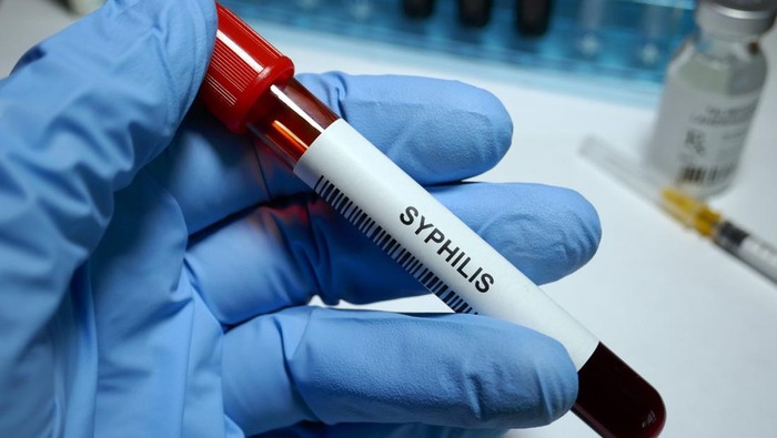 977296796 Syphilis - sexually transmitted disease blood test and treatment