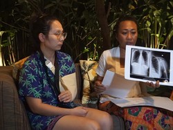 Bule Ribut dengan WNI Usai Dilarang Merokok di Restoran Bali Saling Lapor