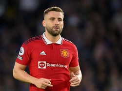 Daftar Cedera MU Bertambah, Luke Shaw Korban Terbaru