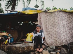 Salut! Gadis dari Kawasan Kumuh Ini Jadi Bintang Iklan Brand Kecantikan