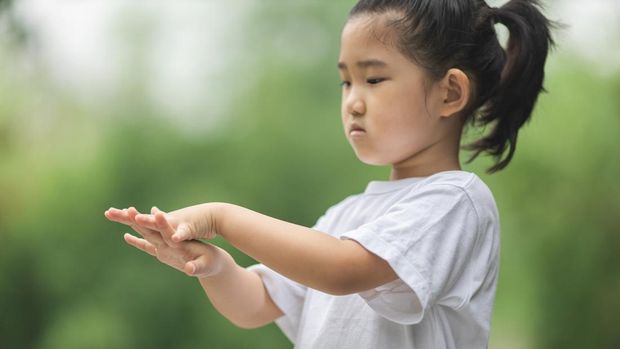 Kulit anak kering