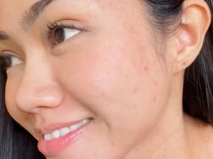Gaya Yura Yunita Percaya Diri Pamer Wajah Berjerawat dan Ketiak Tak Mulus Gaya Yura Yunita Percaya Diri Pamer Wajah Berjerawat dan Ketiak Tak Mulus