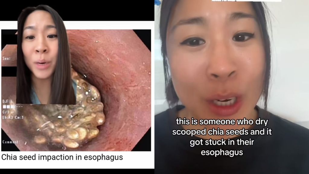 Dampak konsumsi chia seed yang salah