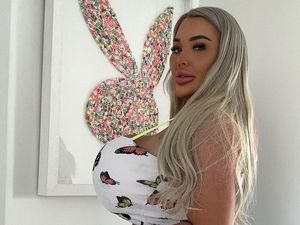 Penampilan Tak Wajar Model dengan Dada 36NN, Dikhawatirkan Meledak