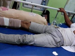 Cekcok dengan Atasan, Kaki PNS di Bangka Selatan Patah