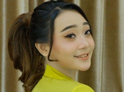 Kondisi Pedangdut Difarina Indra Usai Kecelakaan di Tol