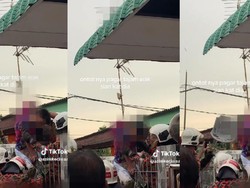 Ngilu, Bokong Bocah Ini Tertusuk Paku Pagar Tembus 15 Cm