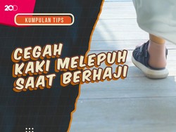 KuTips: Cegah Kaki Melepuh Saat Berhaji di Tengah Cuaca Panas Arab!