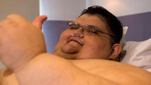 Potret Pria Tergemuk di Dunia yang Berakhir Tragis, Meninggal karena Infeksi Ginjal