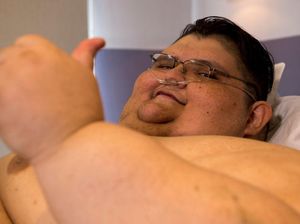 Derita Pria Berbobot 600 Kg hingga Nyaris Meninggal