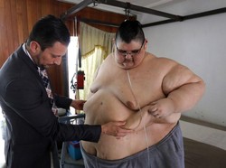 Pria Terberat di Dunia Sampai Operasi Lambung demi Enyahkan Ratusan Kg
