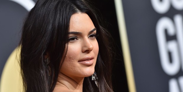 Kendall Jenner perlihatkan jerawat di wajahnya/Foto: Getty Images/Axell/Bauer Griffin