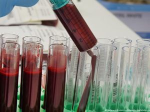 Hemoglobin Adalah: Fungsi, Kadar Normal, dan Penyakit yang Berkaitan Hemoglobin Adalah: Fungsi, Kadar Normal, dan Penyakit yang Berkaitan