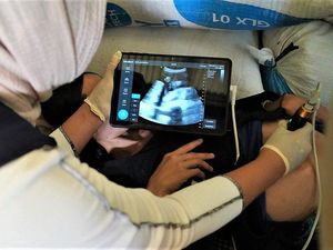 Momen Bumil di Baduy Dalam Mulai Dapat Akses USG di Puskesmas