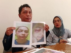 Pilu ASN Istri Polisi di Raja Ampat Babak Belur Dianiaya Suami Sendiri