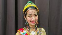 7 Foto Wanita Dulu Viral Wajah dan Tubuh Penuh Tahi Lalat, Nasibnya Kini...