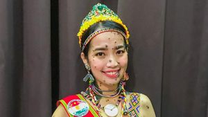 7 Foto Wanita Dulu Viral Wajah dan Tubuh Penuh Tahi Lalat, Nasibnya Kini...