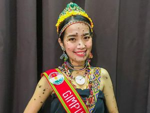7 Foto Wanita Dulu Viral Wajah dan Tubuh Penuh Tahi Lalat, Nasibnya Kini... 7 Foto Wanita Dulu Viral Wajah dan Tubuh Penuh Tahi Lalat, Nasibnya Kini...