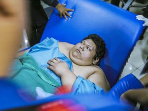 Penyebab Fajri Pria Obesitas 300 Kg Meninggal Dunia, Begini Penjelasan RSCM Penyebab Fajri Pria Obesitas 300 Kg Meninggal Dunia, Begini Penjelasan RSCM