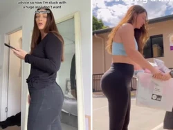 Wanita Ini Kecewa Setelah Operasi Bokong, Sebut Jadi Mirip Shrek