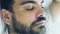 Pria Ini Nekat Injeksi Oli ke Wajah Demi Mirip Ricky Martin, Begini Nasibnya