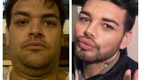 Transformasi Pria yang Nekat Suntikkan Oli ke Wajah demi Mirip Ricky Martin