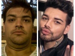 Pria Ini Tempuh Cara Menyakitkan Agar Mirip Ricky Martin Idolanya