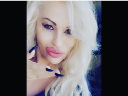 Wanita Ini 200 Kali Operasi Plastik, Ungkap Sisi Gelap Hidupnya