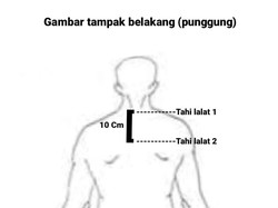 Fakta-fakta Temuan Terbaru Mutilasi Sidoarjo: Ada Dua Tahi Lalat-Tinggi 170 Cm