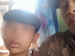 Kasus Siswa SD di Pasuruan yang Alami Kekerasan Berakhir Damai