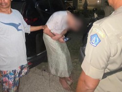 Masih Dirawat di RS, Bule Rusia Tanpa Celana Belum Bisa Dideportasi