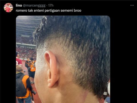 Marselino Ferdinan pamer luka akibat pelanggaran Christian Romero.
