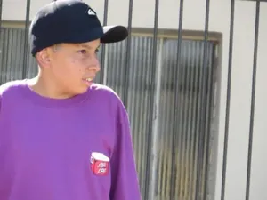 Pria Dewasa Alami Kondisi Langka Jadi Bak Remaja 13 Tahun, Ini Penampilannya