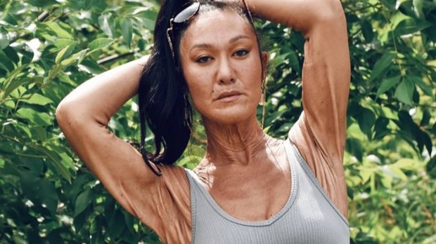 Kisah inspiratif perempuan dengan kondisi kulit genetik