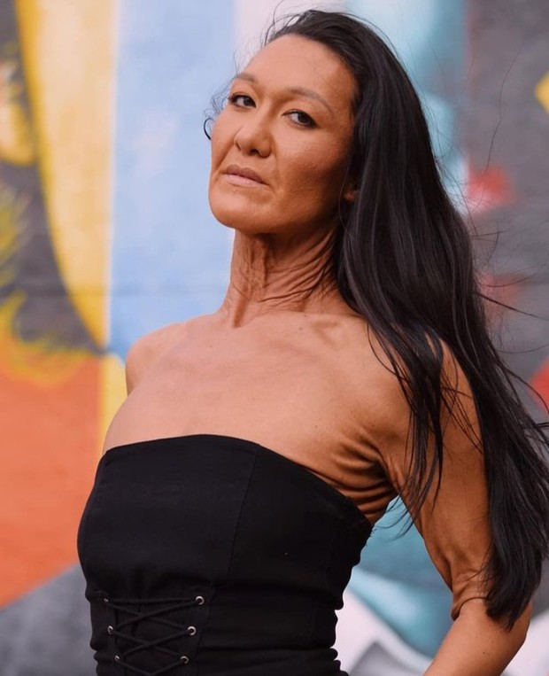 Kisah inspiratif perempuan dengan kondisi kulit genetik