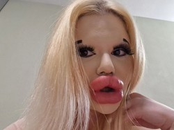 Most Pop Sepekan: Potret Wanita dengan Bibir Terbesar Setelah 43 Kali Filler