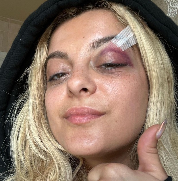Bebe Rexha/Foto: Instagram.com/beberexha insiden artis internasional yang diserang penggemar