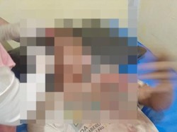 Warga Gresik Tewas Dihajar Tetangga Hanya Gegara Kunyit