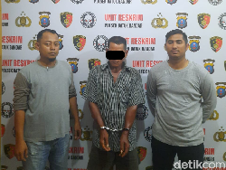 Suami Bakar Istri di Tanjungbalai gegara Kerja di Kafe