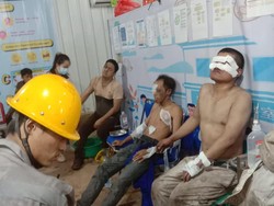 7 Karyawan PT GNI Morowali Utara Terkena Semburan Api, 1 Tewas-6 Luka