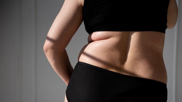 Lemak punggung bawah dan pinggang/Foto: Freepik.com Kesehatan tubuh berdasarkan jenis lemak