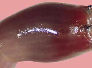 Cacing Darah Bergigi Logam Terlihat Jinak Padahal Berbahaya