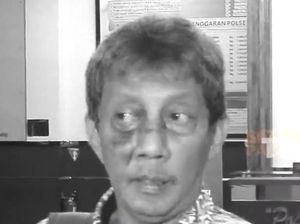 Kondisi Terduga Korban Kasus Penganiayaan Pierre Gruno