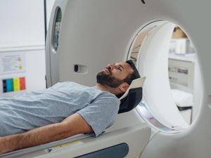Kapan Waktu yang Tepat untuk CT Scan Jantung?