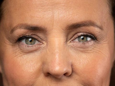 Kulit keriput dan garis halus