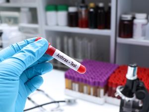 Imbauan Kementan Terkait Hewan yang Terpapar Antraks