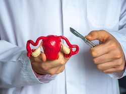 Waspada! Menstruasi Tak Normal Bisa Berpotensi Miom & Kista Ovarium