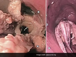 Pria Ini Muntah-muntah Gegara di Tenggorokannya Nyangkut Gurita Besar