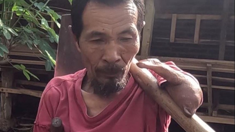 Pak Sabar Tegar Jalani Hidup Tanpa 2 Tangan Sempurna, Yuk Kita Bantu