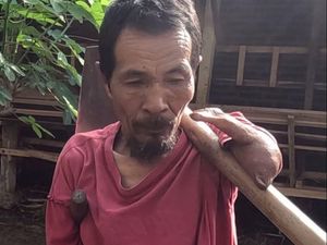 Pak Sabar Tegar Jalani Hidup Tanpa 2 Tangan Sempurna, Yuk Kita Bantu